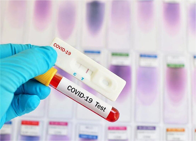 Bu gün 9 nəfər koronavirusa yoluxub, ölən olmayıb – STATİSTİKA