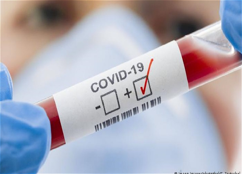 Bu gün 11 nəfər koronavirusa yoluxub – STATİSTİKA