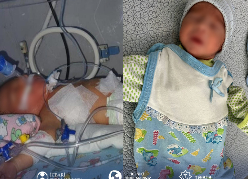 В КМЦ спасли жизнь ребенку с врожденным пороком сердца и пневмонией – ФОТО