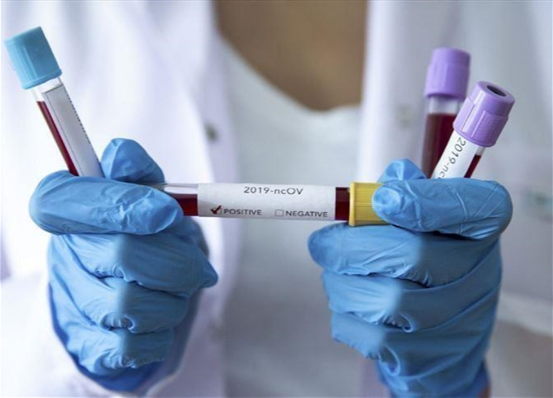 В Азербайджане еще 32 человека заразились коронавирусом