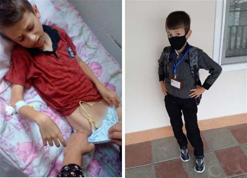 ПРИЗЫВ О ПОМОЩИ. 12-летнему Чингизу нужна операция, иначе он может не выжить… - ФОТО - ВИДЕО