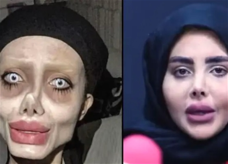 «Иранская Джоли» вышла из тюрьмы и показала своё настоящее лицо без фотошопа - ФОТО