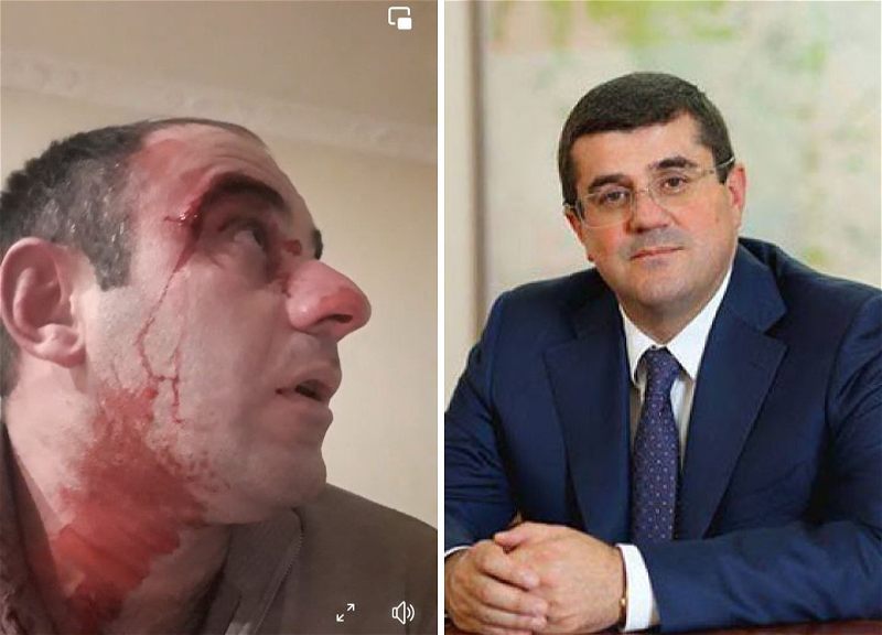 Бандит Араик Арутюнян терроризирует жителей Карабаха - ВИДЕО