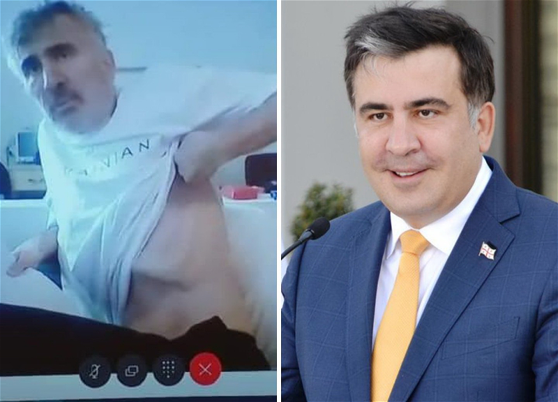 Исхудавший Саакашвили поделился ужасающими фотографиями из больницы – ФОТО
