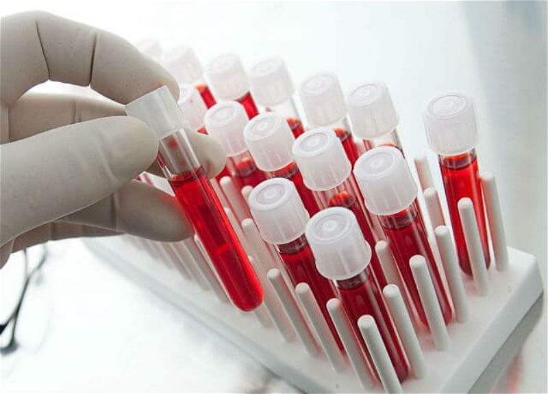 Минздрав: Планируя семью, важно проверить совместимость групп крови