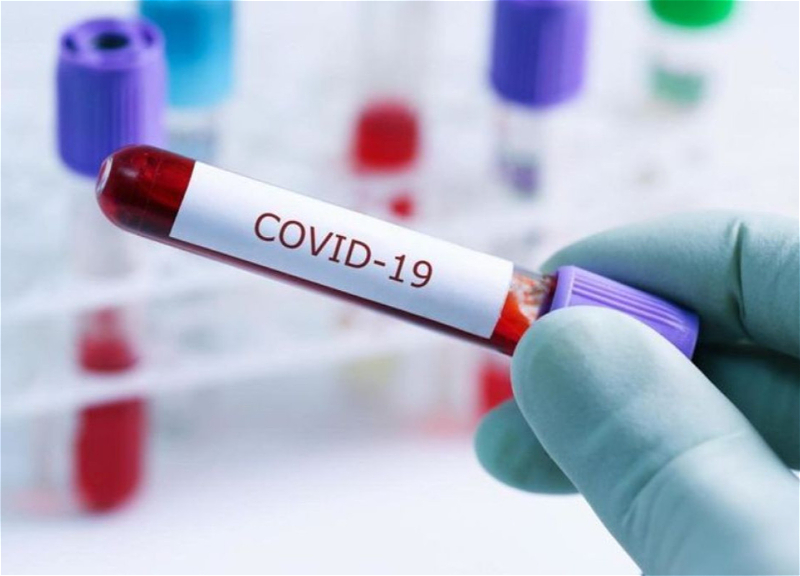 Azərbaycanda daha 2 nəfər COVID-19-a yoluxub