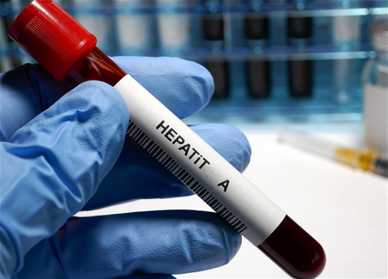 Минздрав сделал заявление в связи со случаями заражения гепатитом А