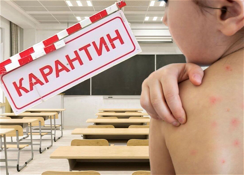 Будут ли закрыты школы в Азербайджане из-за вспышки кори? - Отвечает Эмин Амруллаев
