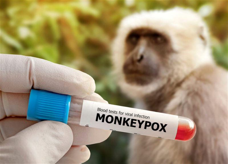 WHO reports monitoring the situation with monkeypox in Russia