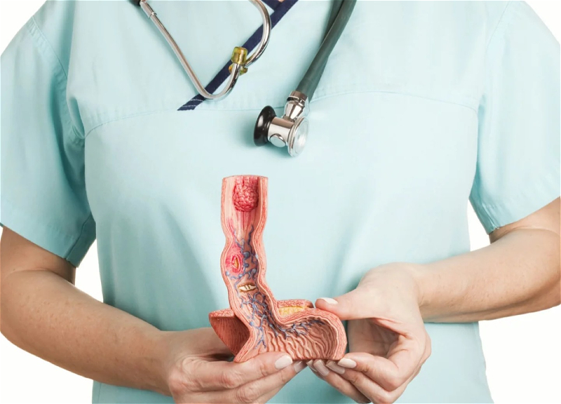 China creates AI model for esophageal cancer screening