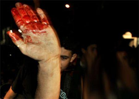 Азербайджанцы Ирана подвергаются пыткам