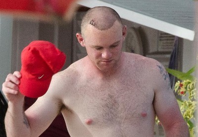 Лысеющему Уэйну Руни снова пересадили волосы