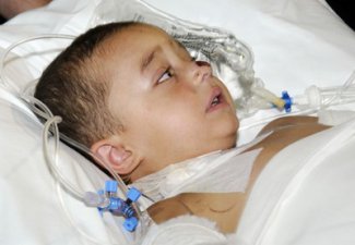 Лишившийся в Набрани ног Имран Джафарзаде вновь прооперирован в Германии