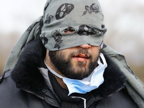 В французском Кале иранские беженцы зашили себе рты – ФОТО - ВИДЕО