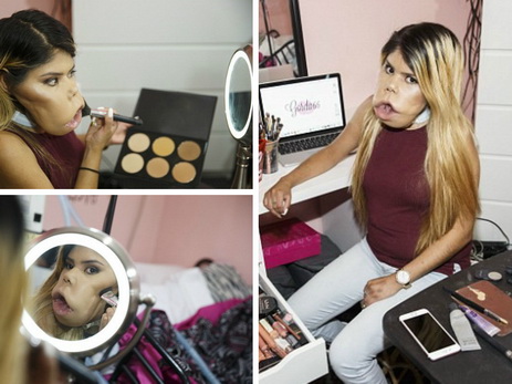 Влогер с врожденной опухолью на лице, не способная ни есть ртом, ни говорить, делает бьюти-обзоры - ФОТО - ВИДЕО