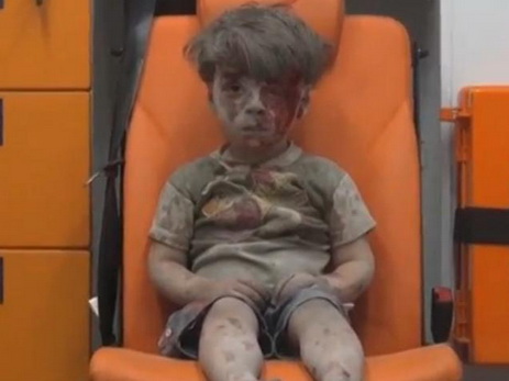 Кадры с окровавленным мальчиком из Алеппо потрясли мир – ВИДЕО