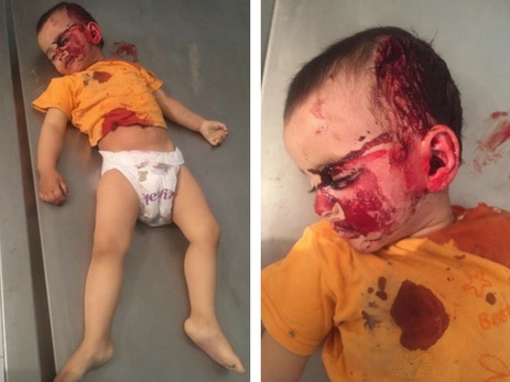 Опубликовано фото тела ребенка, расстрелянного армянскими войсками – ФОТО