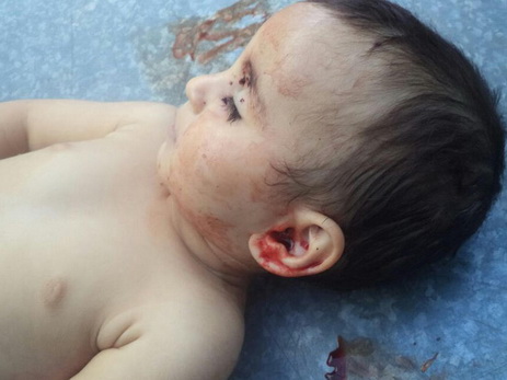 Армянская сторона признала убийство азербайджанского ребенка