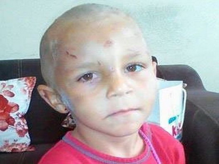 В Баку родители жестоко избивали четырехлетнего ребенка, требуя попрошайничать – ФОТО