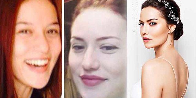 Догадаться невозможно: 9 турецких актрис-красавиц до и после пластики